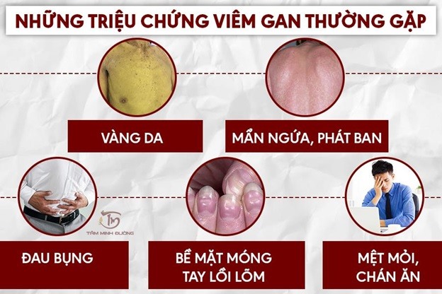 viêm gan là gì - Image 2