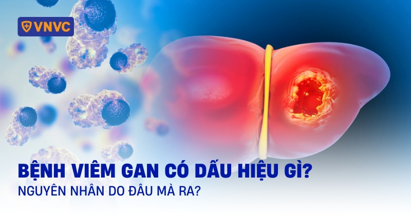 viêm gan là gì - Image 5