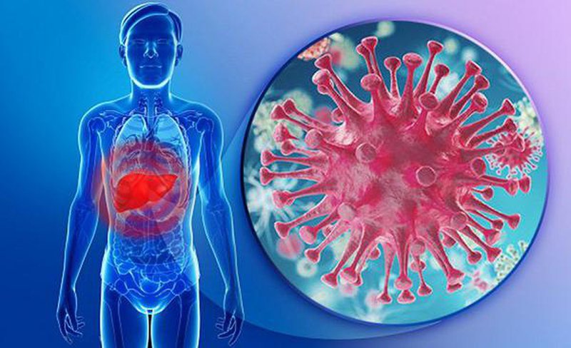 viêm gan virus - Image 3