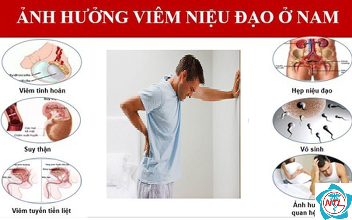 viêm niệu đạo - Image 2