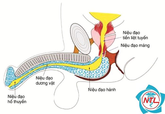 viêm niệu đạo - Image 3