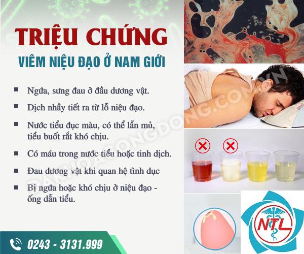 viêm niệu đạo - Image 4