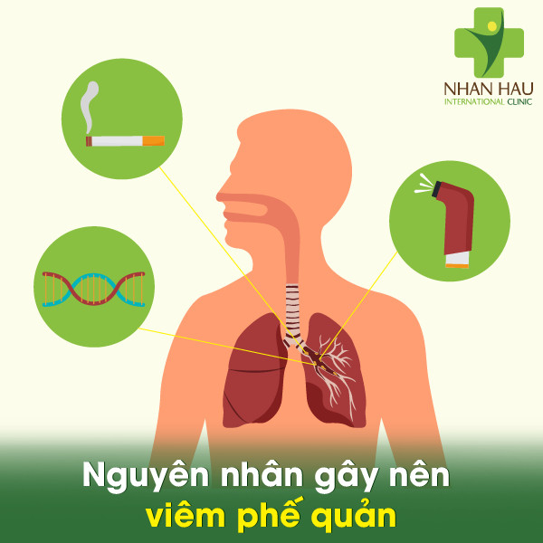viêm phế quản kéo dài nhiều tuần - Image 4