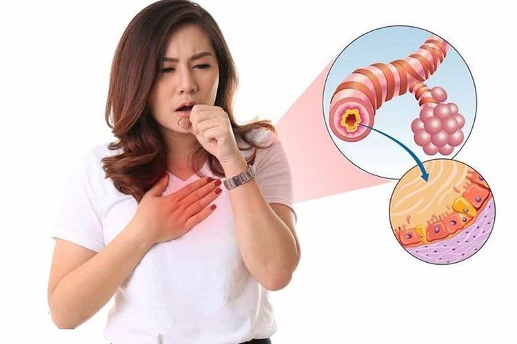 viêm phế quản mạn tính - Image 3