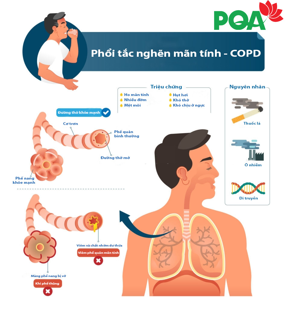 viêm phế quản và copd - Image 4