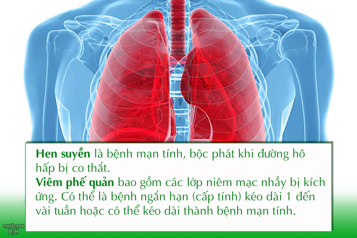viêm phế quản và hen phế quản - Image 3