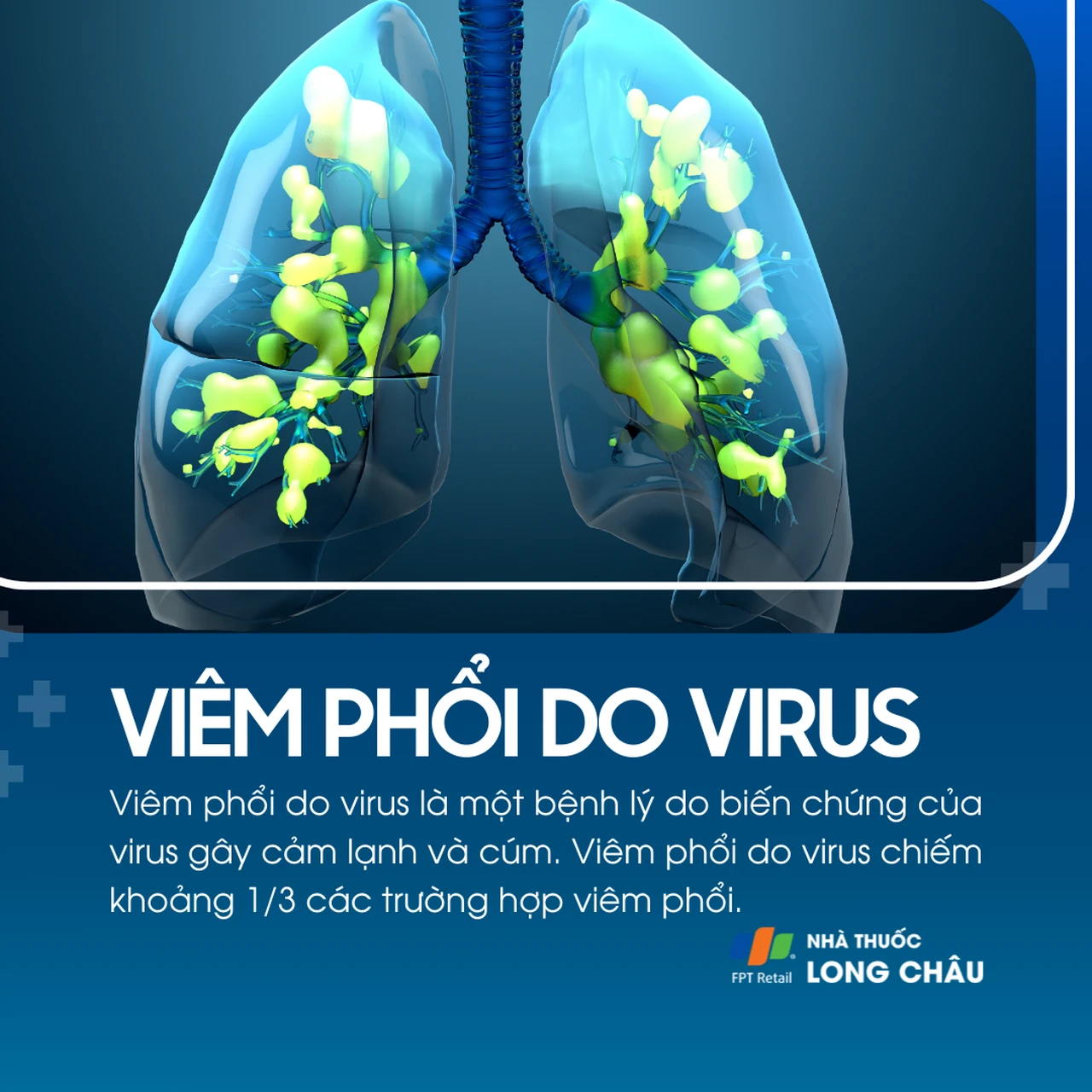 viêm phổi do virus ở người lớn - Image 2