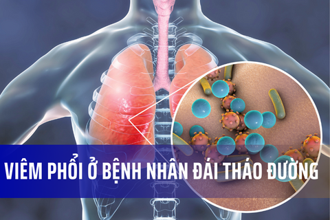 viêm phổi ở người tiểu đường - Image 3