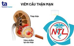 viêm thận mạn