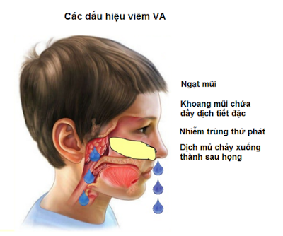 viêm va ở trẻ - Image 2