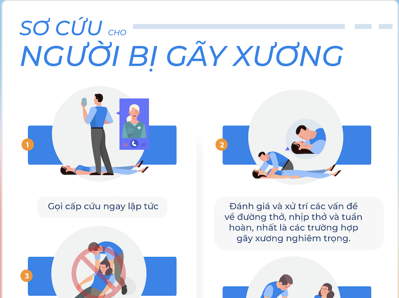 xử trí gãy xương - Image 2