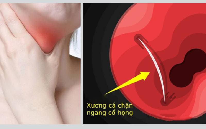 xương cá có tự tiêu không - Image 2