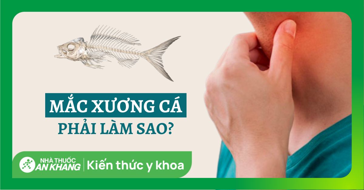 xương cá mắc cổ làm sao - Image 5