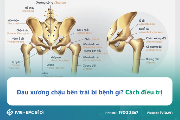 xuong chau bi dau - Image 4