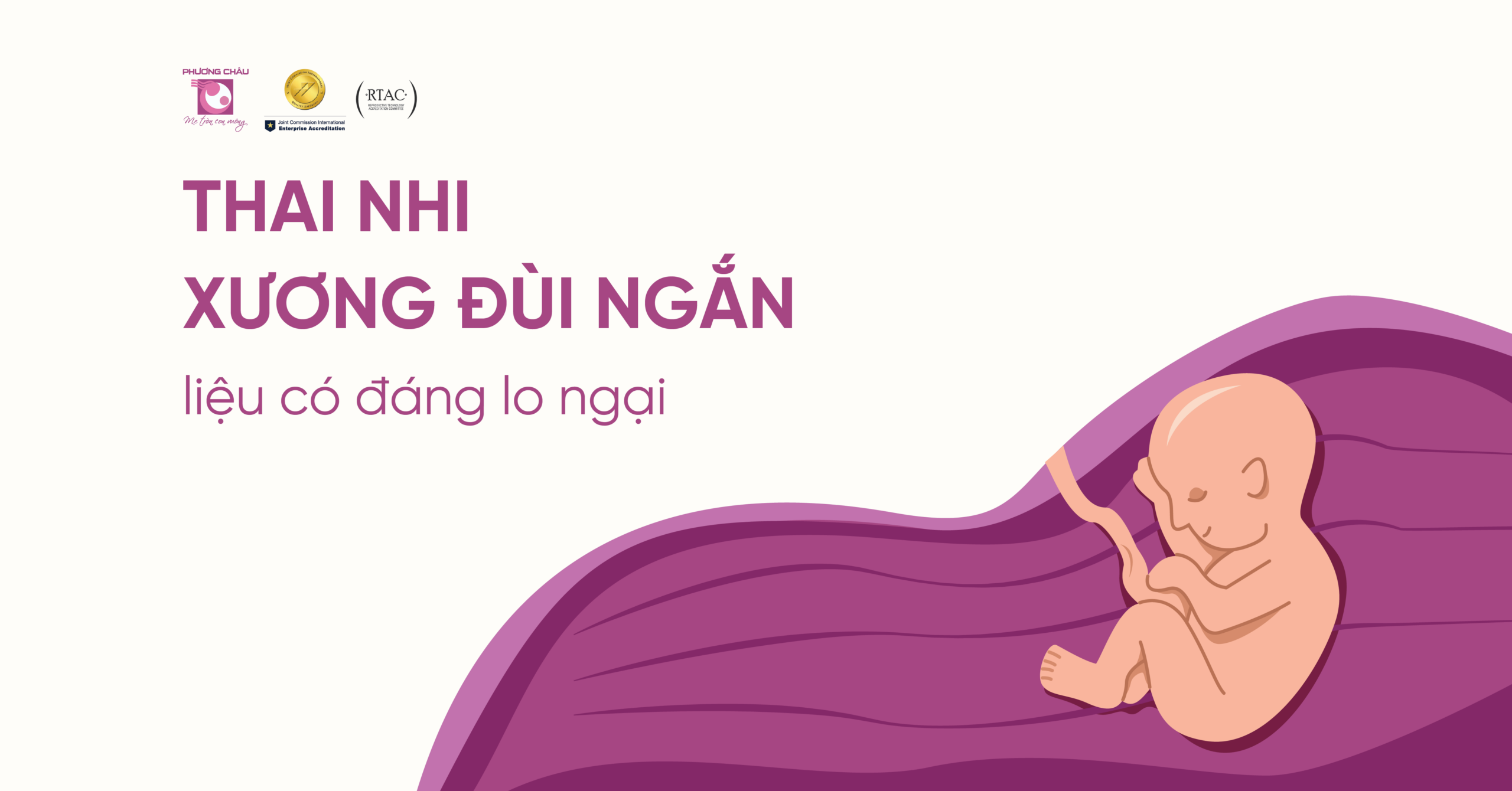 xương đùi ngắn - Image 1