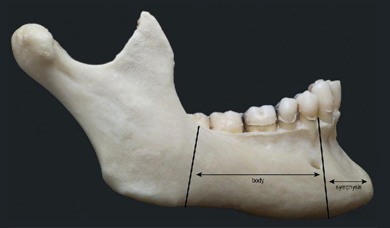 xương hàm dưới - Image 5