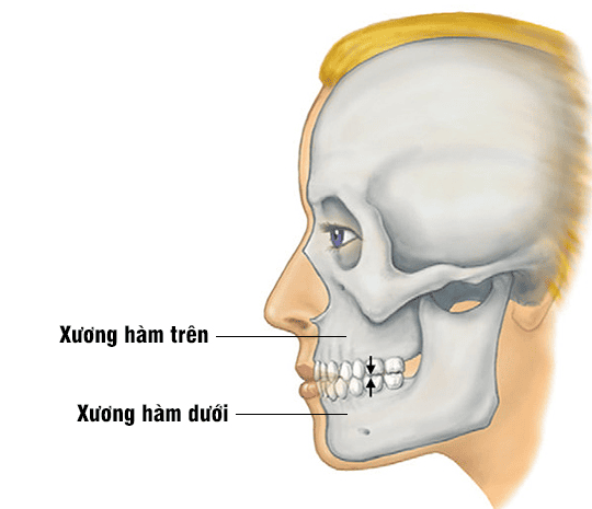 xương hàm trên - Image 4
