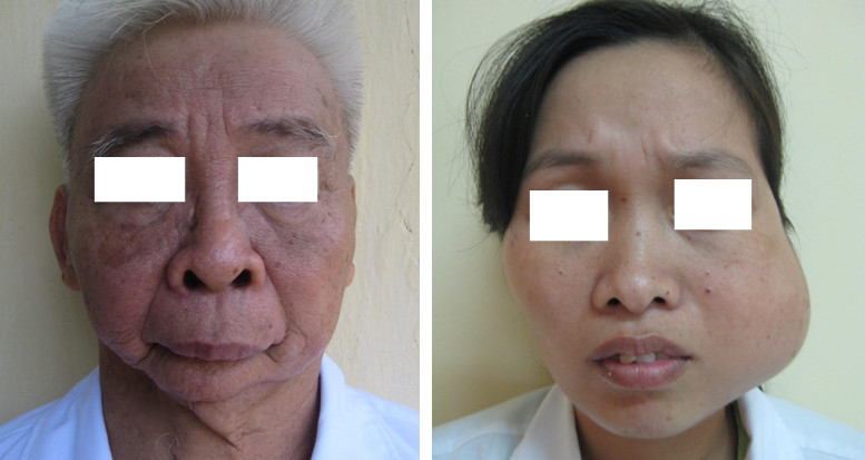 xương mặt to - Image 4