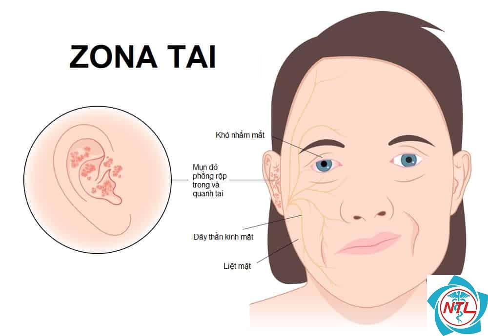 zona tai - Image 3