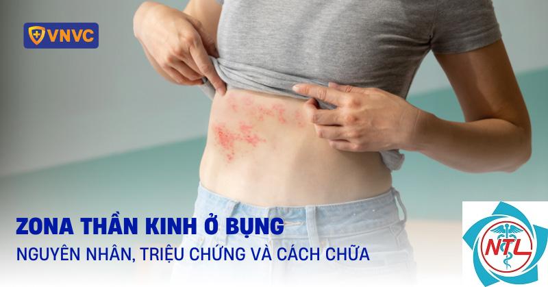 zona vùng bụng - Image 4