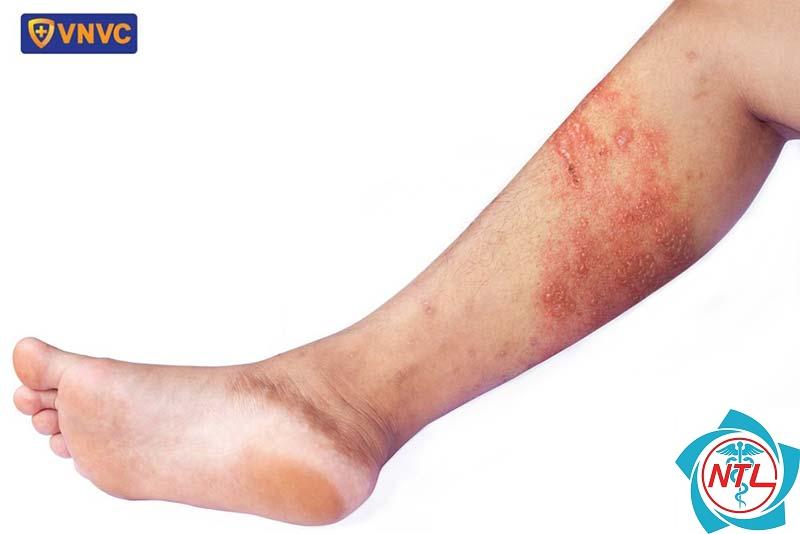 zona vùng chân - Image 3