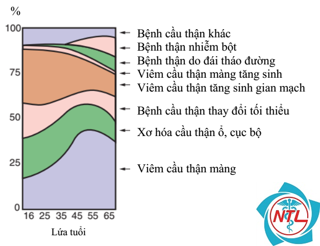 bệnh cầu thận thay đổi tối thiểu - Image 3