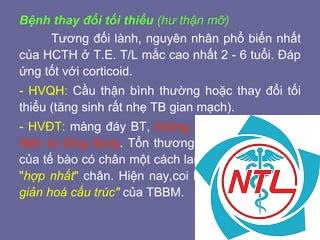 bệnh cầu thận thay đổi tối thiểu