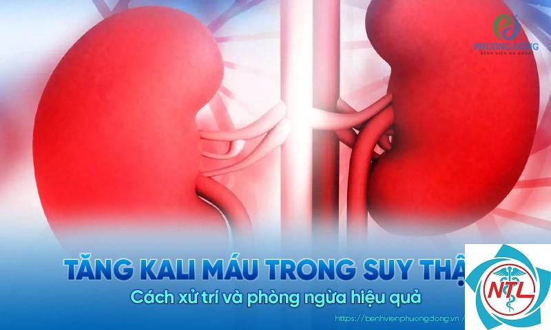 bệnh thận do giảm kali máu - Image 3