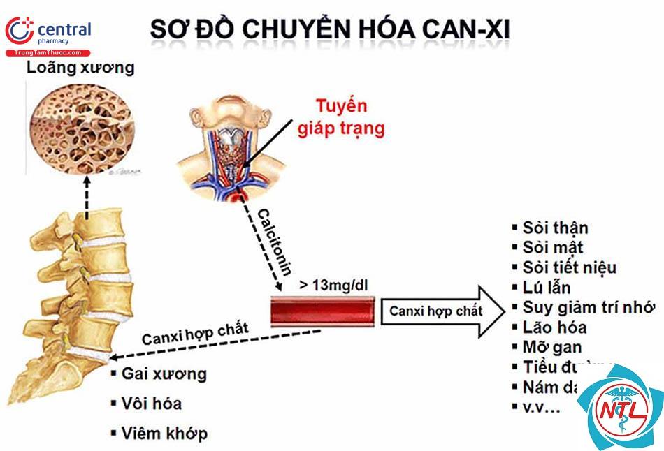 bệnh thận do tăng canxi máu - Image 2