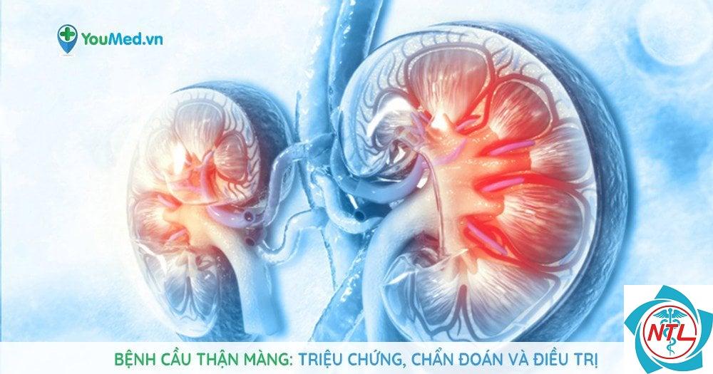 bệnh thận màng - Image 2