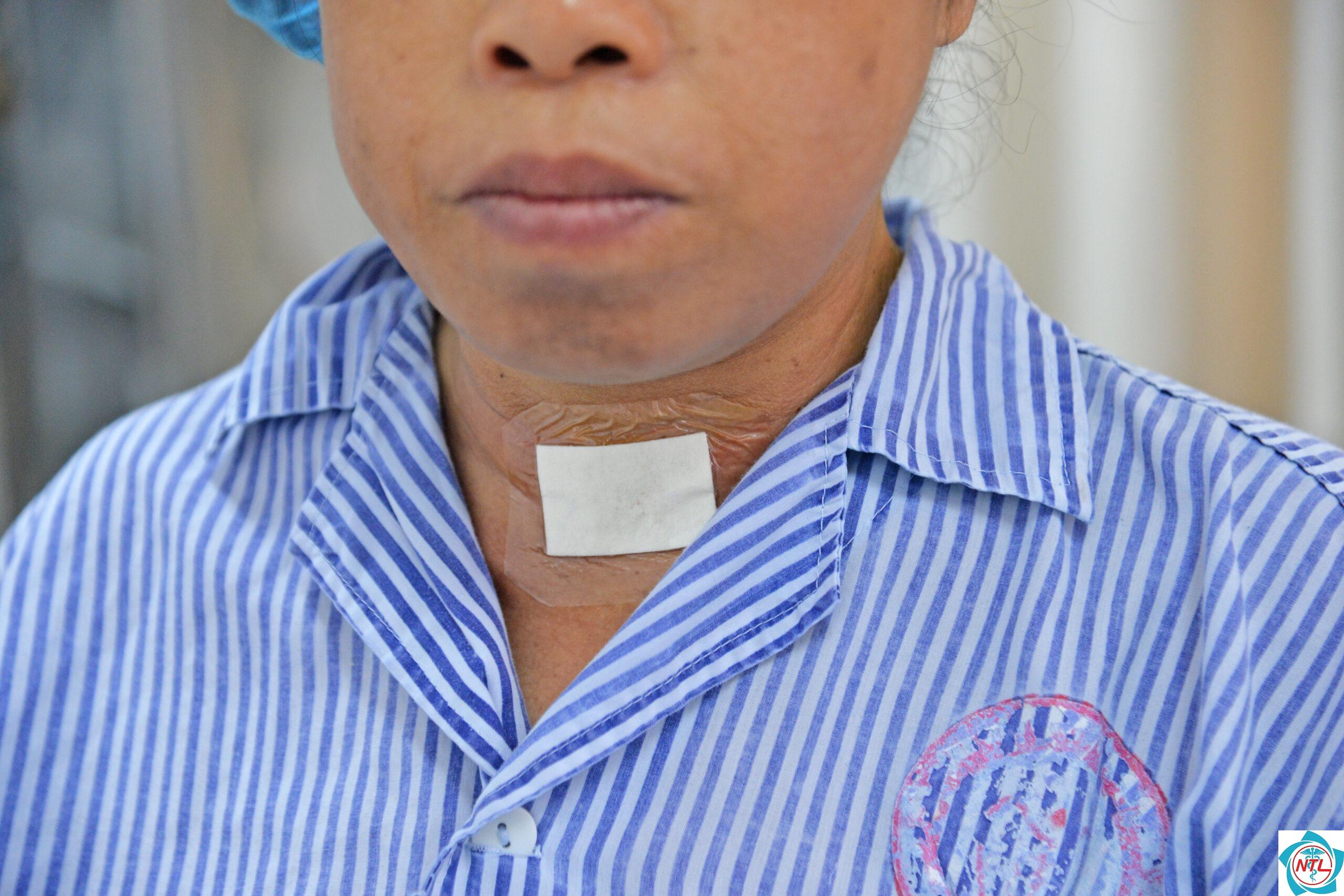 cường cận giáp do bệnh thận - Image 4