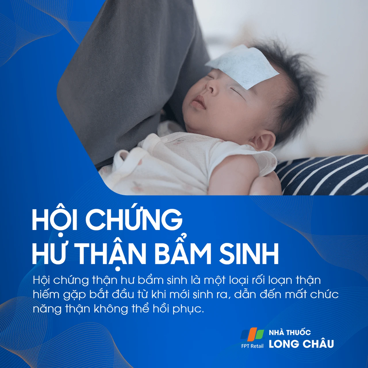 hội chứng thận hư bẩm sinh - Image 2