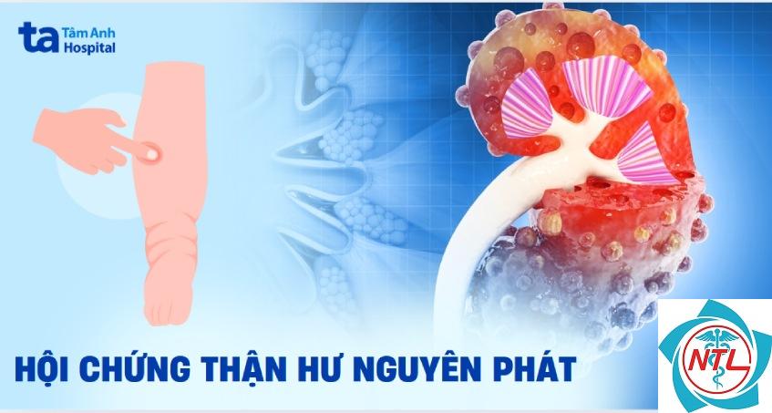 hội chứng thận hư nguyên phát