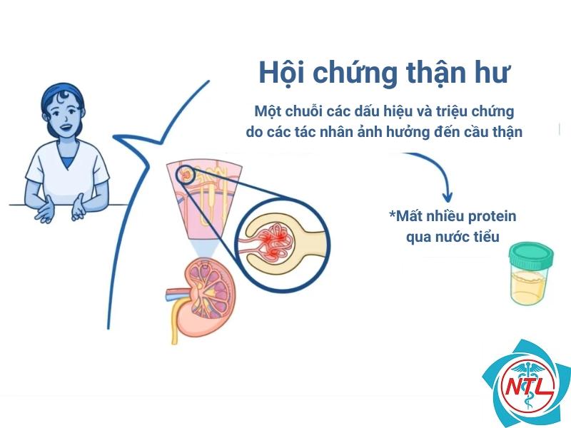 hội chứng thận hư thứ phát - Image 5