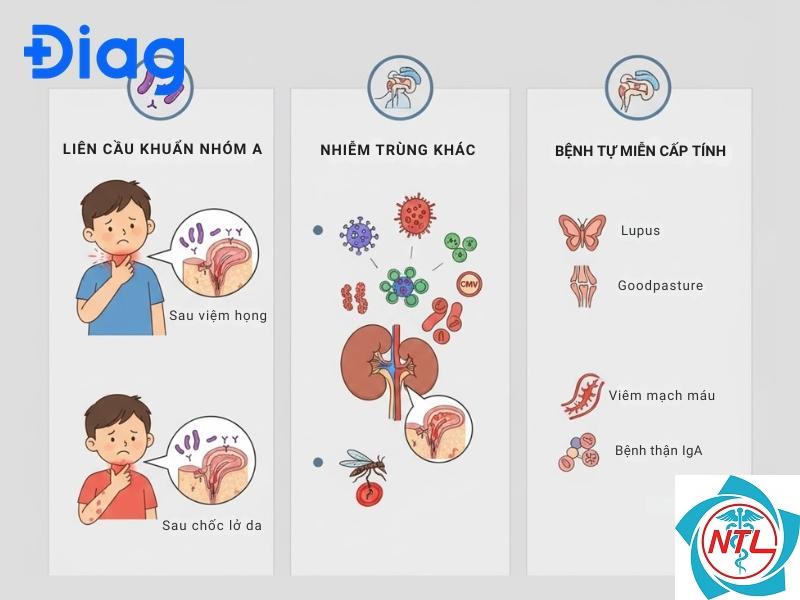 hội chứng thận viêm cấp - Image 2