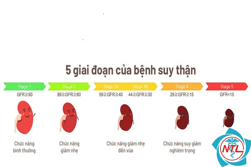 hội chứng thận viêm mạn - Image 5