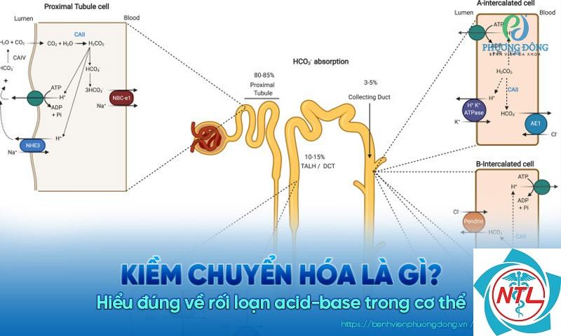kiềm chuyển hóa do bệnh thận