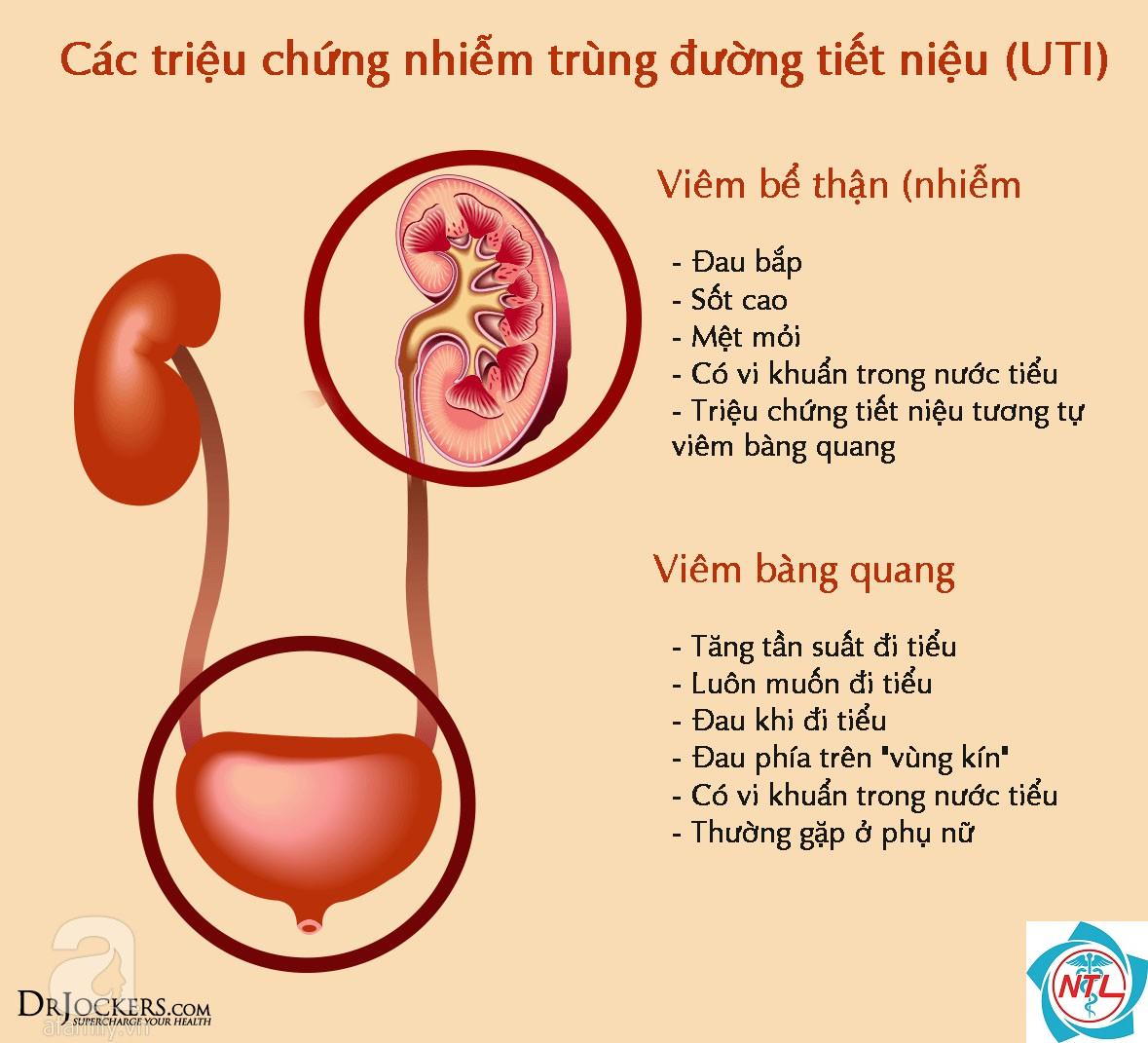 nang thận nhiễm trùng - Image 3