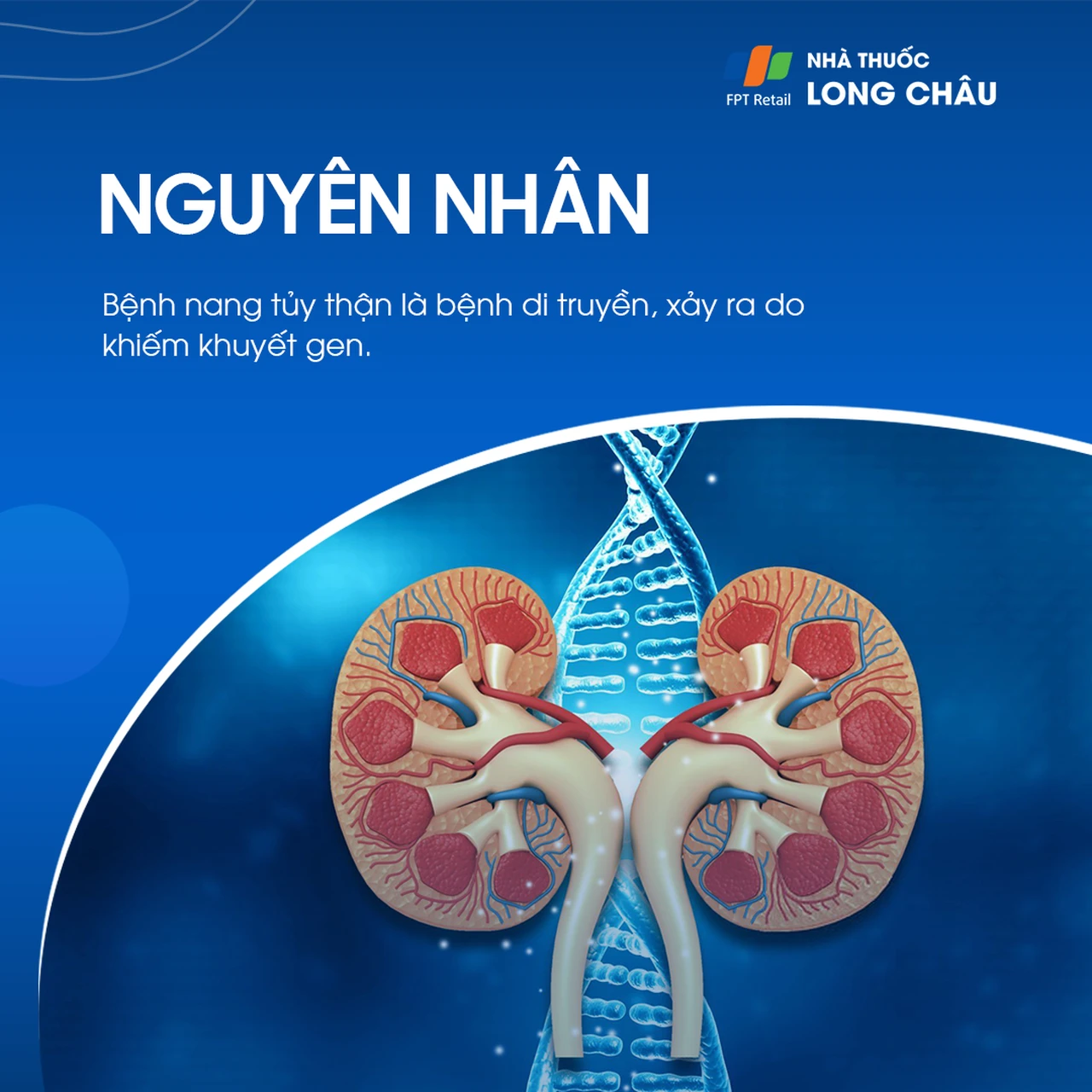 nang tủy thận - Image 3