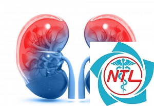 nhiễm độc urê huyết