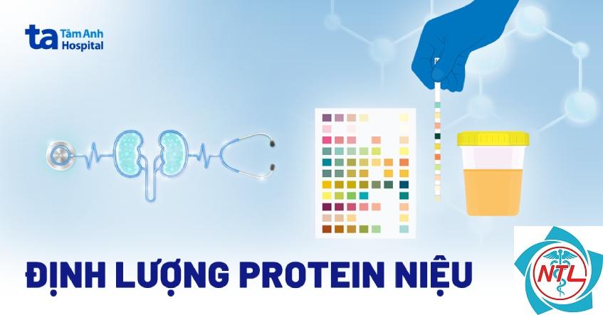 protein niệu chọn lọc - Image 3