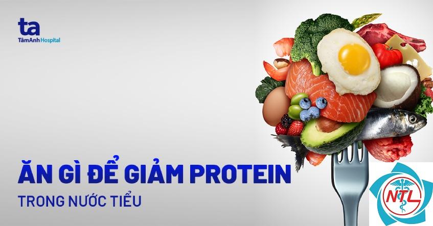 protein niệu không chọn lọc - Image 4