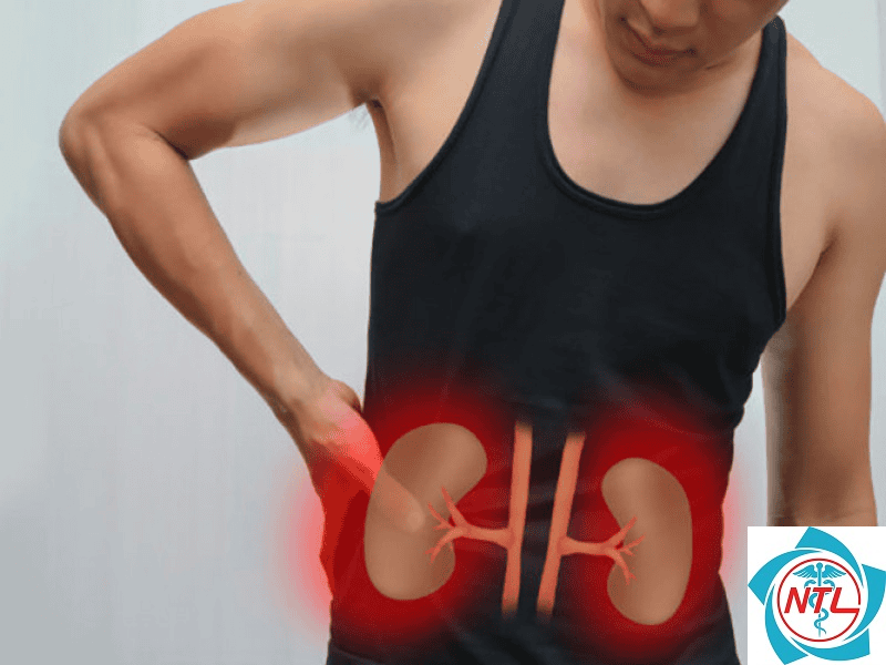 rối loạn chức năng ống thận - Image 3