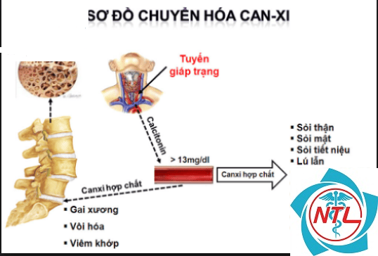 rối loạn phospho do bệnh thận - Image 2
