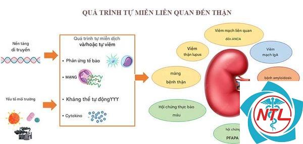 suy thận cấp do bệnh tự miễn