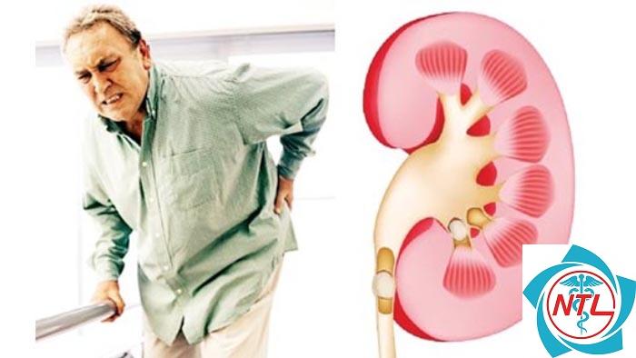 suy thận mạn ở người cao tuổi