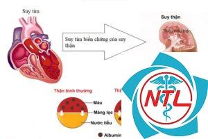 tổn thương tim mạch do suy thận