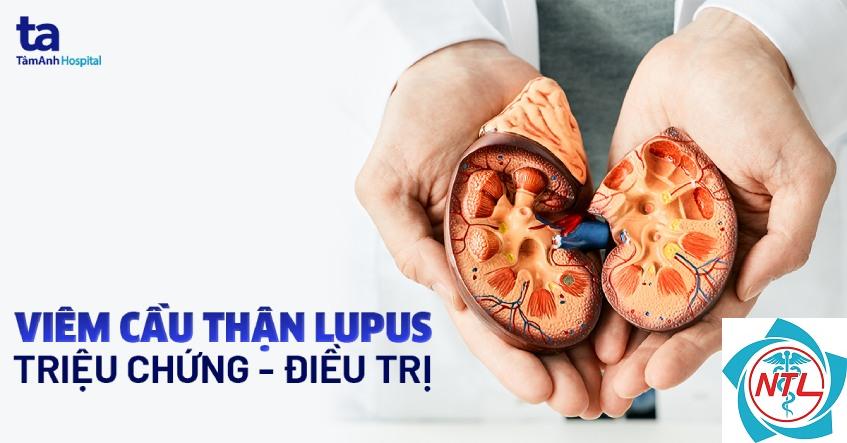 viêm cầu thận do lupus - Image 3