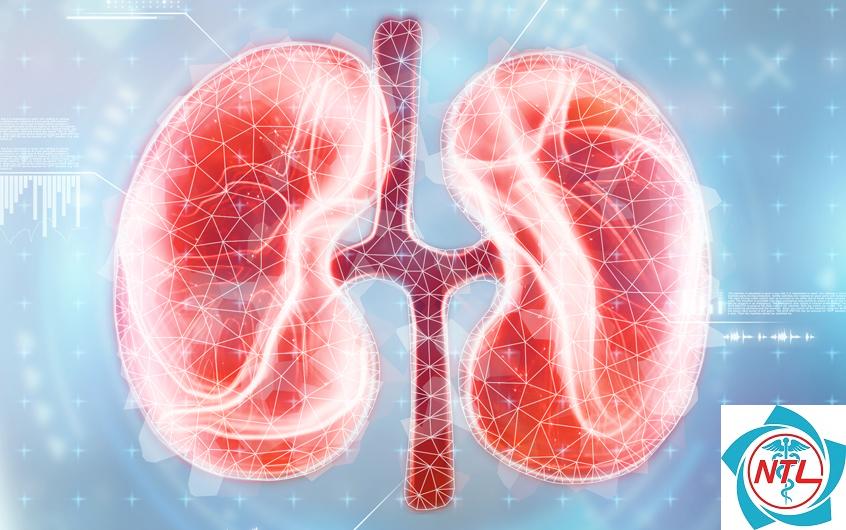 viêm cầu thận do lupus - Image 5
