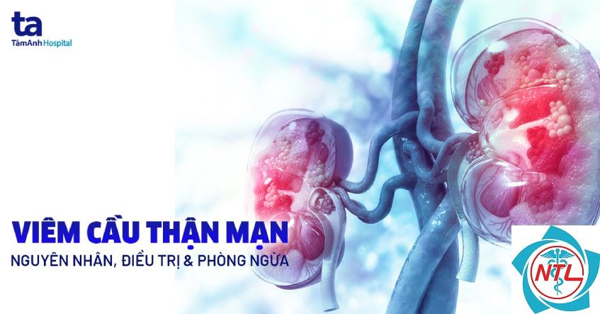 viêm cầu thận pauci-immune - Image 4